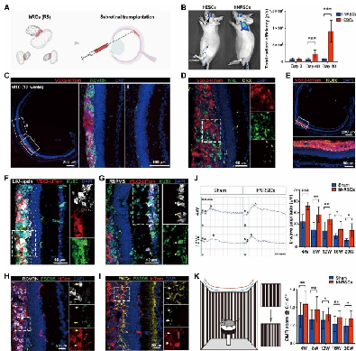 图3 小鼠体内移植hNRSC进行功能性视网膜修复